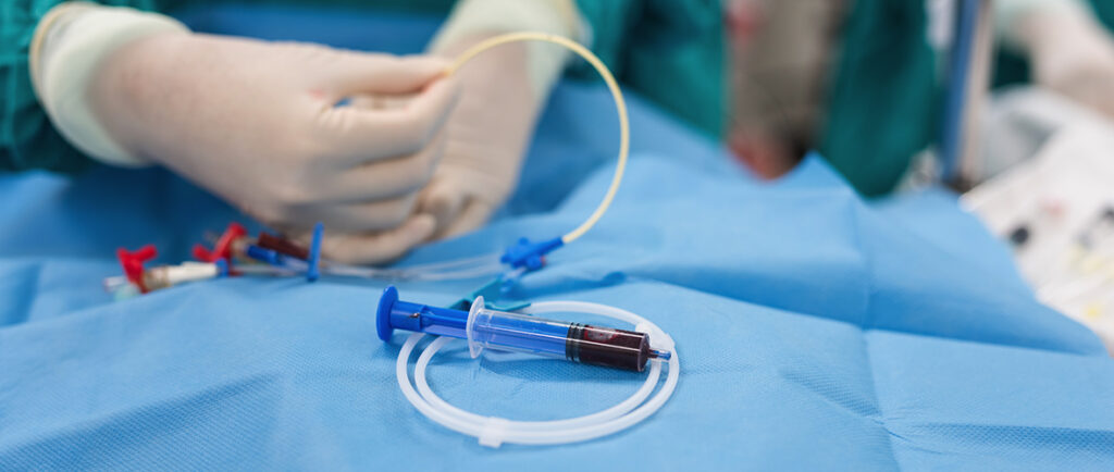 custom catheter manufacturing