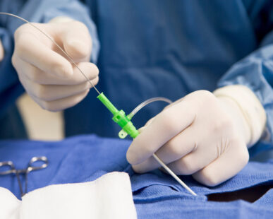 catheter manufacturing challenges and trends and strategies