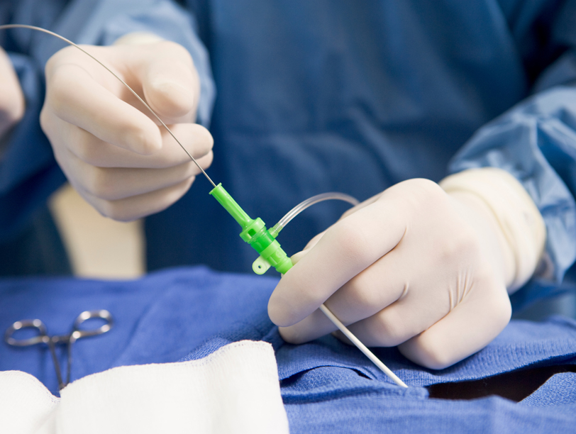 catheter manufacturing challenges and trends and strategies